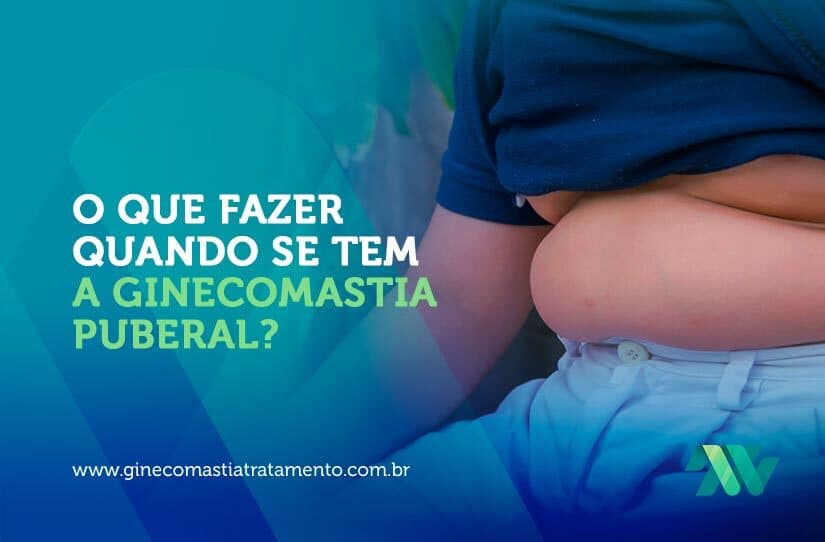 O que fazer quando se tem a ginecomastia puberal?