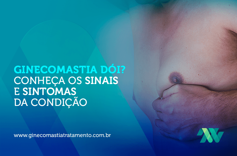 Ginecomastia dói? Conheça os sinais e sintomas da condição